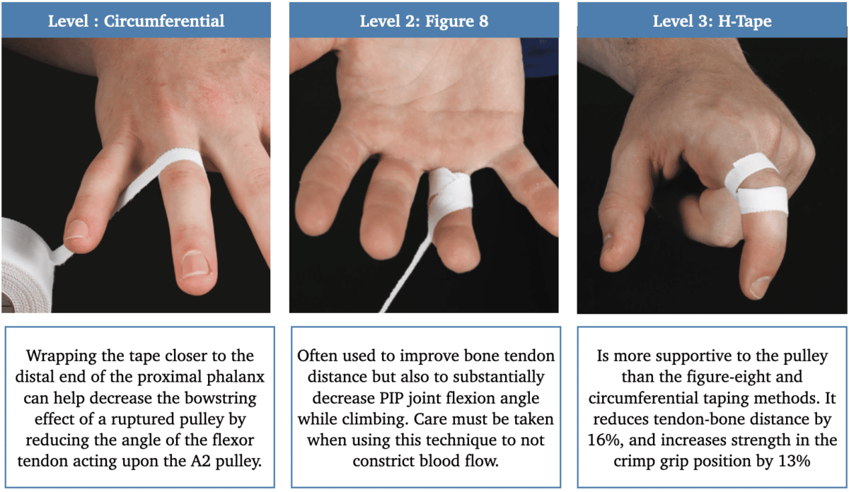 How To Rehab A Climbing Finger Pulley Injury The Climbing Doctor