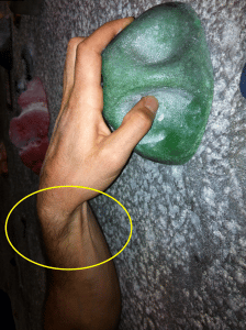 climbing with excessive wrist flexion