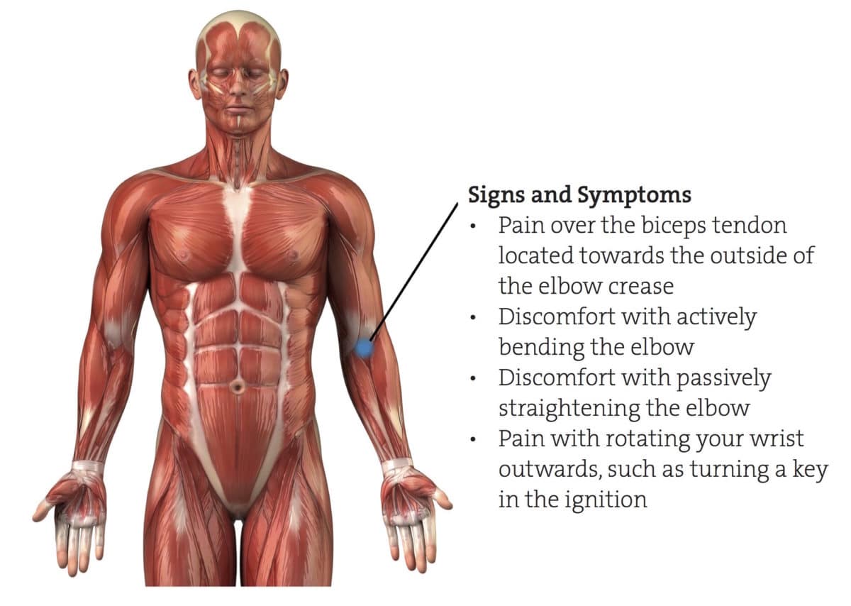 Right deals bicep pain