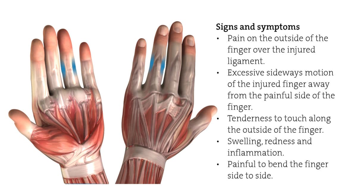 collateral ligament hand