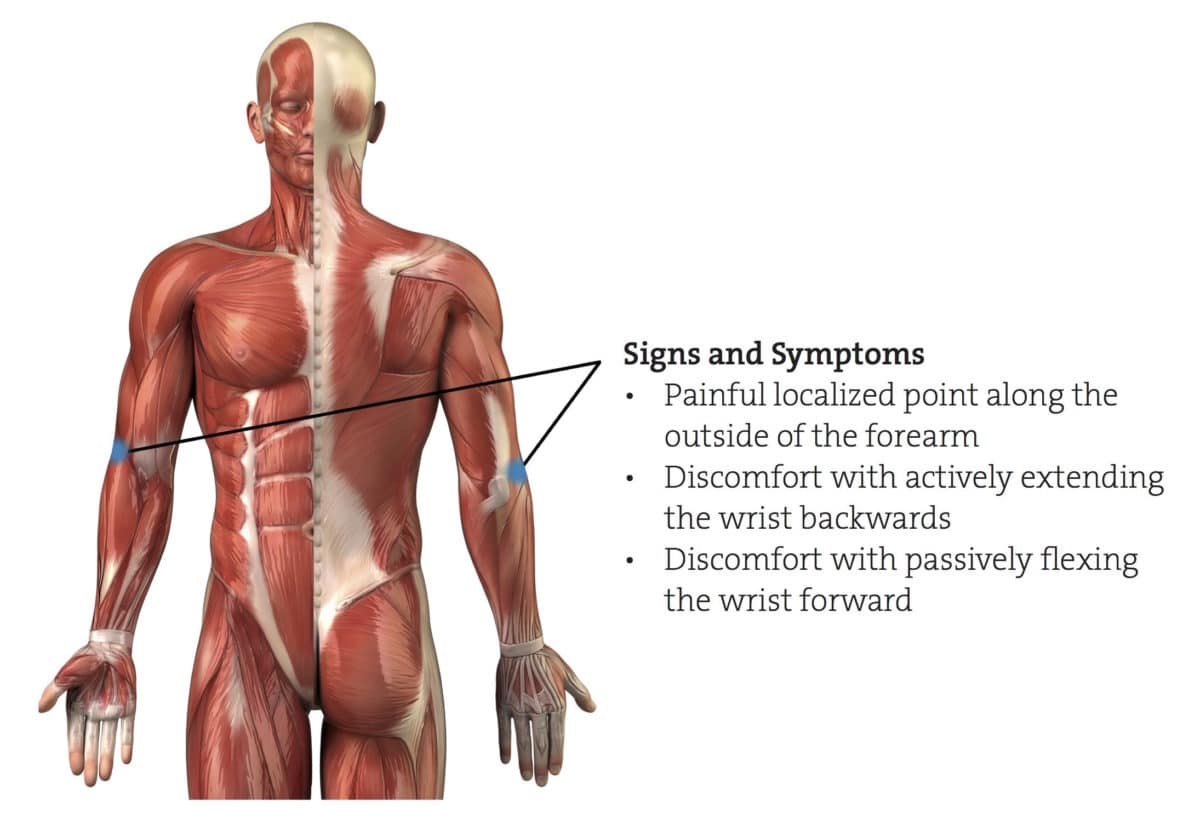 Lateral Epicondylosis Rehabilitation Program Climbing