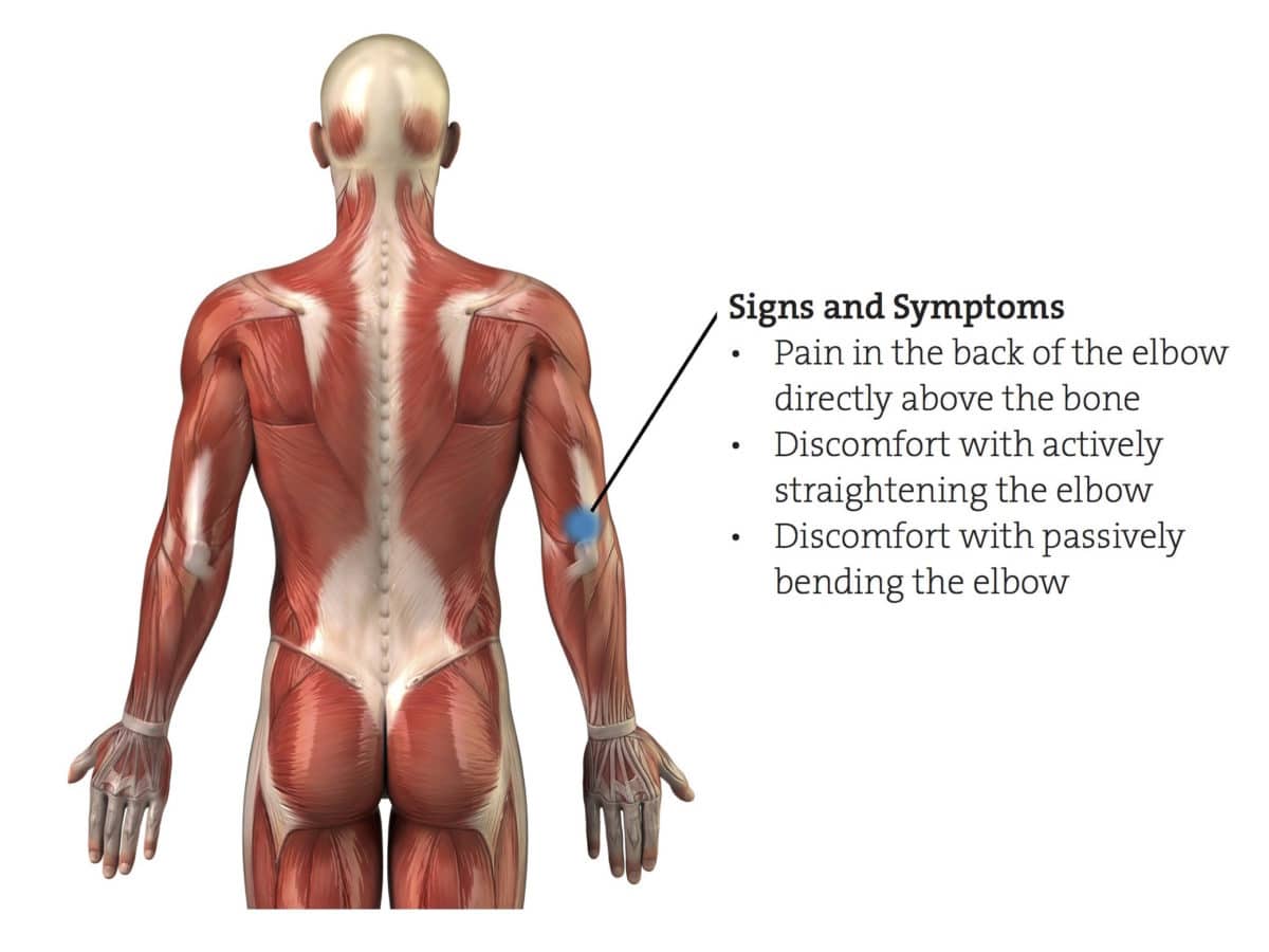 Triceps Tendinopathy - The Climbing Doctor