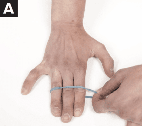 Collateral Ligament Sprain – The Climbing Doctor