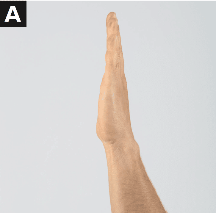Finger tendon glides A