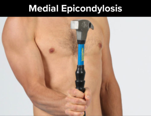 Medial Epicondylosis