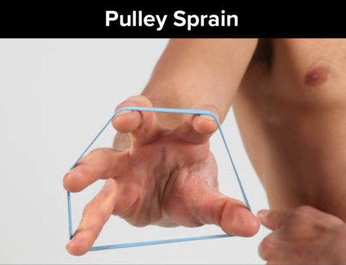 Pulley Sprain