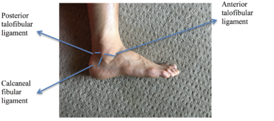 How to Prevent Ankle Sprains in Bouldering - The Climbing Doctor
