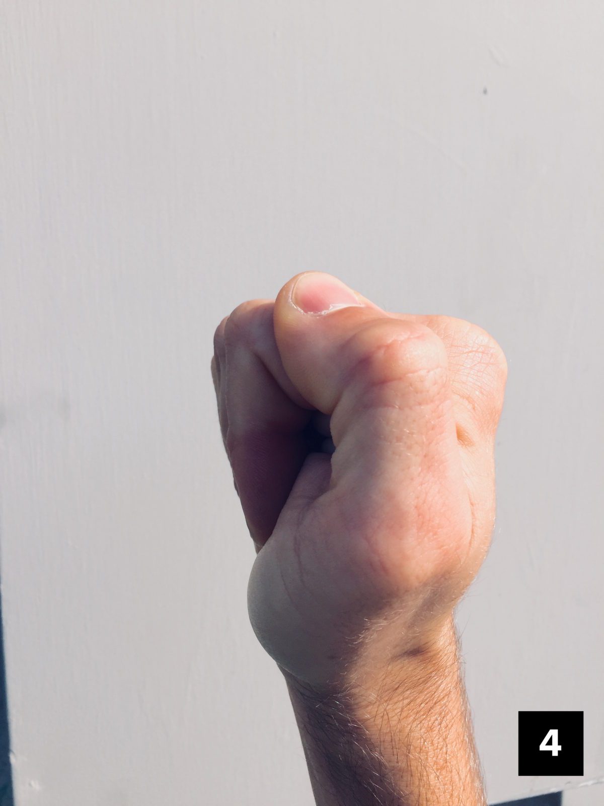 Pulley Injuries Explained Part 2 The Climbing Doctor