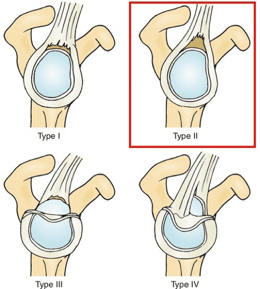 Upper Limb  Clinical Gate