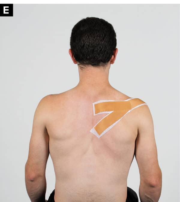 Rock Climbing Injury Tips Shoulder Taping The Climbing Doctor