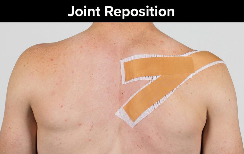 Leukotape The Climbing Doctor