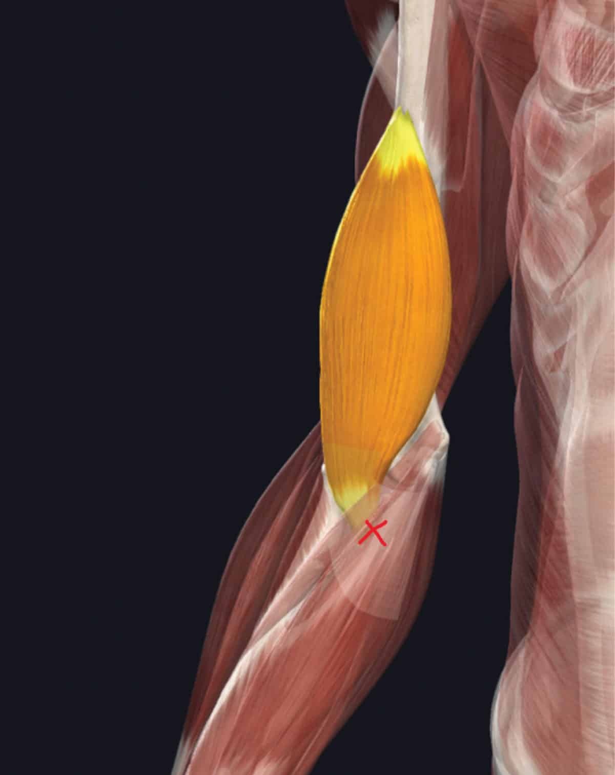 Brachialis Tendinopathy in Climbers - The Climbing Doctor