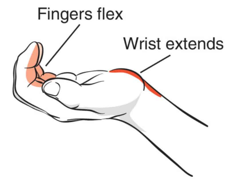 Rock Climbing Finger Tenosynovitis - The Climbing Doctor