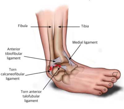 Improving Ankle Stability for More Successful Climbing - The Climbing ...