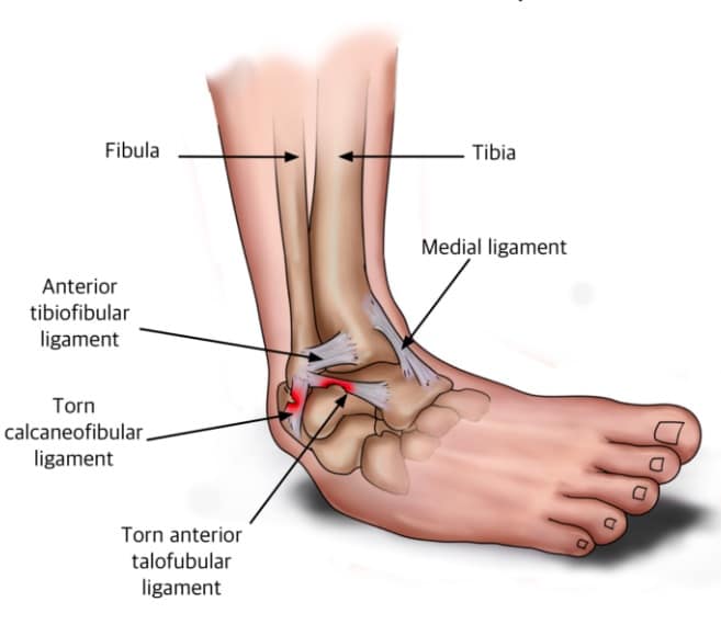 Improving Dynamic Ankle Stability