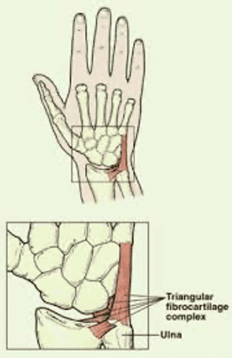 ulnar wrist pain causes