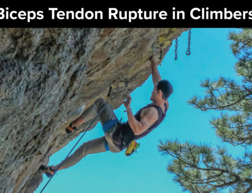 Biceps Tendon Rupture in Climbers