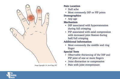 Capsulitis And Synovitis Climbing Swelling Of The Fingers The   Finger Capsulits And Synovitis Climber 1 400x263 