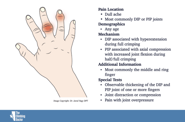 Capsulitis And Synovitis Climbing Swelling Of The Fingers The   Finger Capsulits And Synovitis Climber 1 600x395 