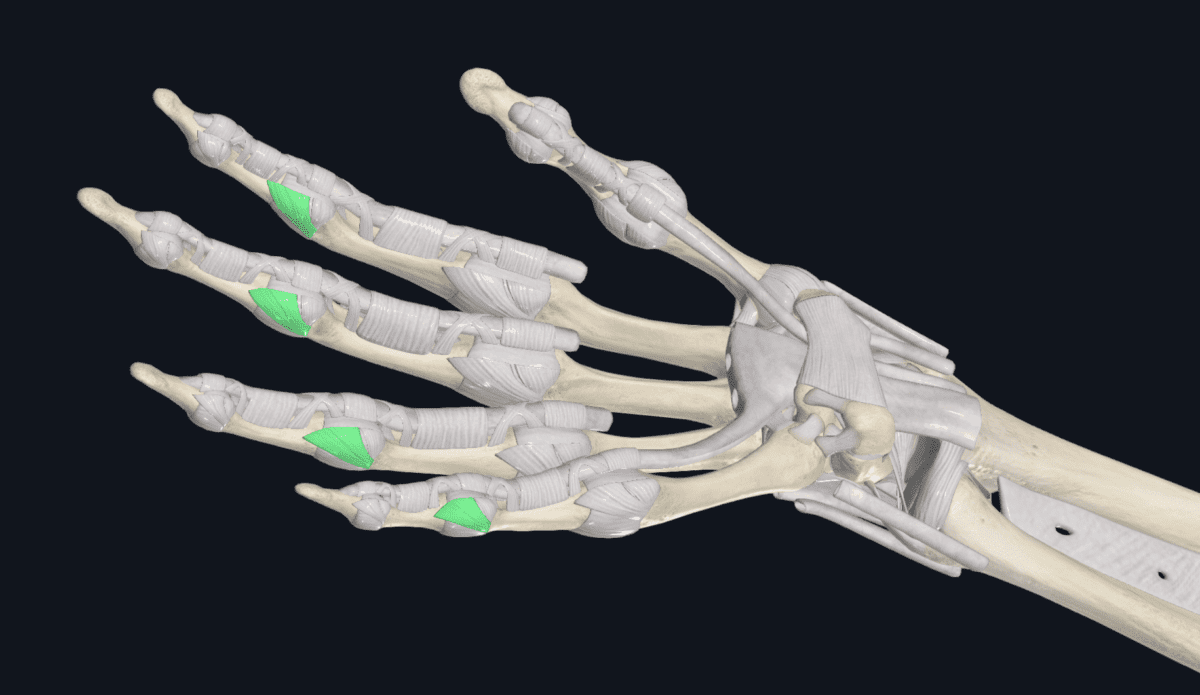 Collateral Ligament Finger Injuries in Climbers The Climbing Doctor