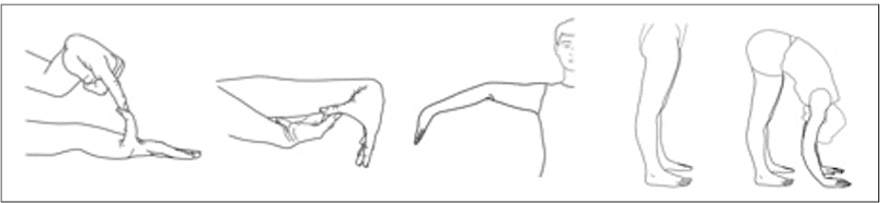 Ehlers-Danlos Syndrome (EDS) Evaluation & Management for the Rock Climber_1