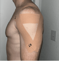 Climbing with Shoulder Hypermobility_9